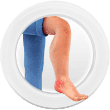 Skin monitoring